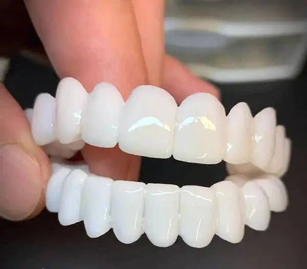 Removable Dental Lens